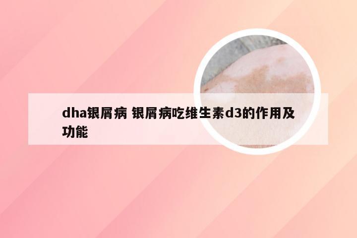 dha银屑病 银屑病吃维生素d3的作用及功能