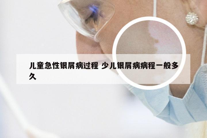 儿童急性银屑病过程 少儿银屑病病程一般多久
