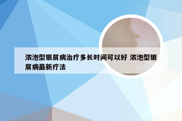 浓泡型银屑病治疗多长时间可以好 浓泡型银屑病最新疗法