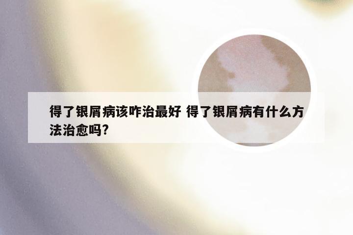 得了银屑病该咋治最好 得了银屑病有什么方法治愈吗?