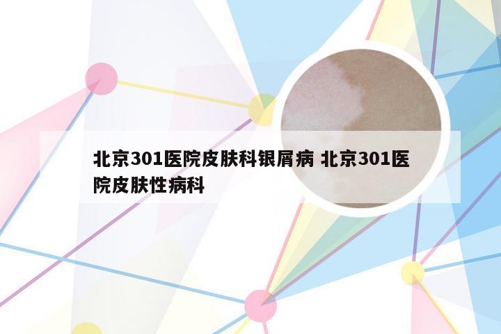 北京301医院皮肤科银屑病 北京301医院皮肤性病科
