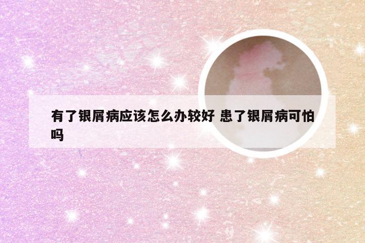 有了银屑病应该怎么办较好 患了银屑病可怕吗
