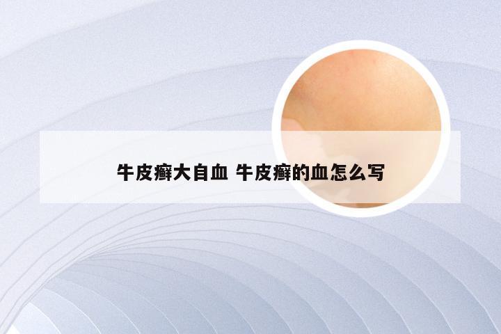 牛皮癣大自血 牛皮癣的血怎么写