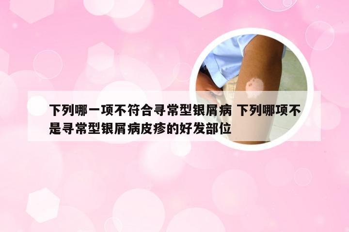 下列哪一项不符合寻常型银屑病 下列哪项不是寻常型银屑病皮疹的好发部位