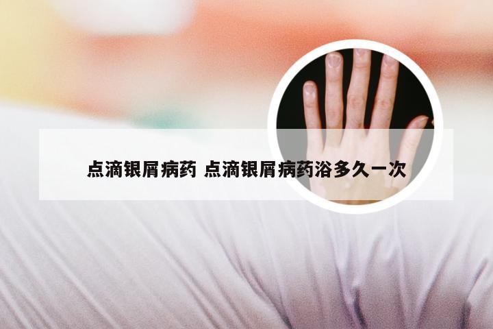 点滴银屑病药 点滴银屑病药浴多久一次