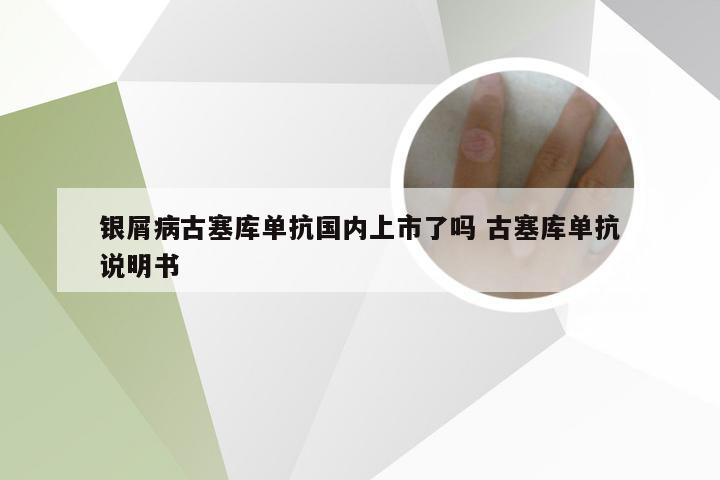 银屑病古塞库单抗国内上市了吗 古塞库单抗说明书