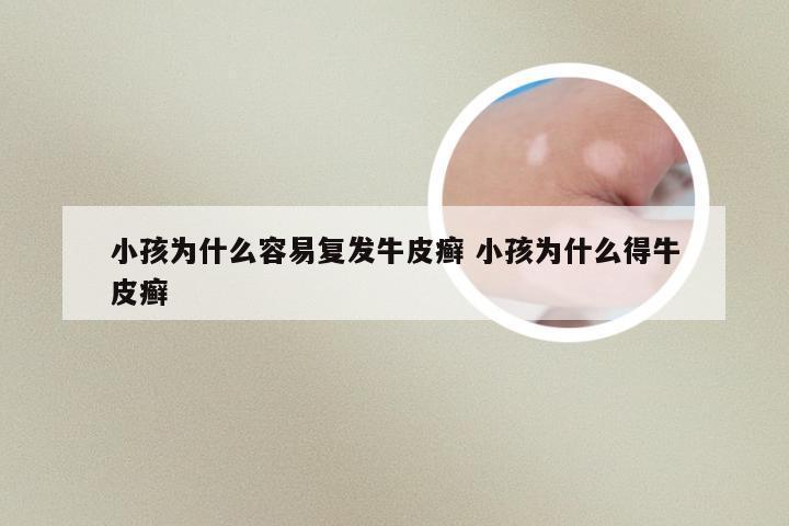 小孩为什么容易复发牛皮癣 小孩为什么得牛皮癣