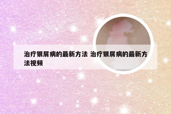 治疗银屑病的最新方法 治疗银屑病的最新方法视频