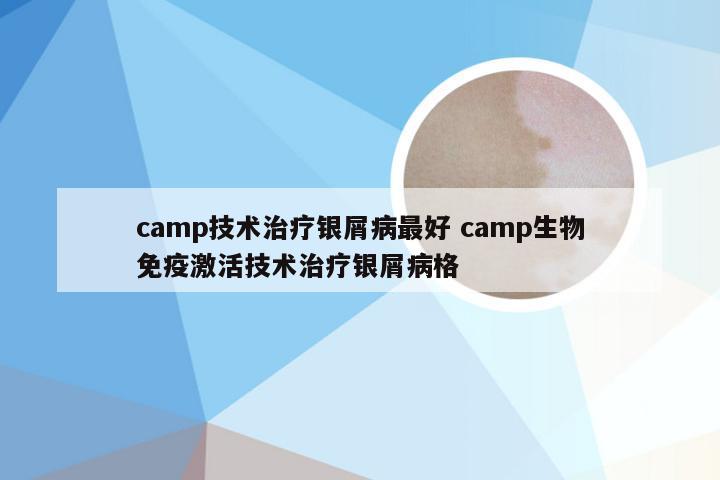 camp技术治疗银屑病最好 camp生物免疫激活技术治疗银屑病格