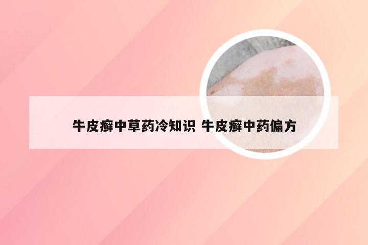 牛皮癣中草药冷知识 牛皮癣中药偏方