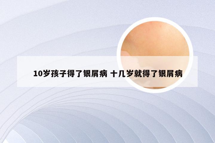 10岁孩子得了银屑病 十几岁就得了银屑病