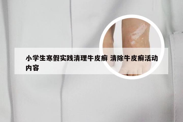 小学生寒假实践清理牛皮癣 清除牛皮癣活动内容