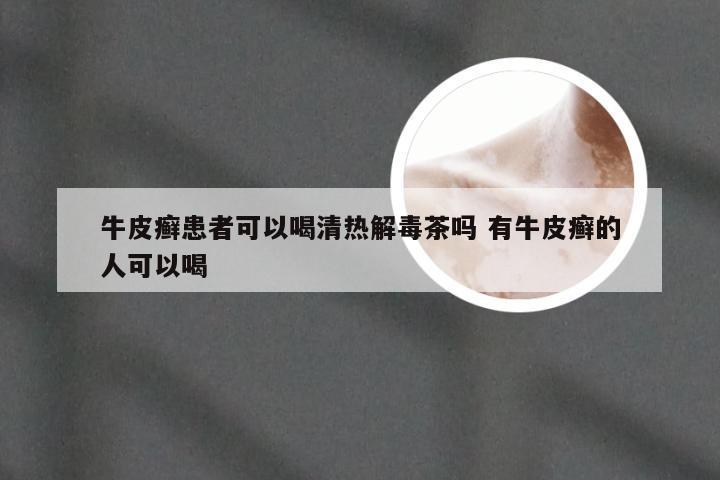 牛皮癣患者可以喝清热解毒茶吗 有牛皮癣的人可以喝