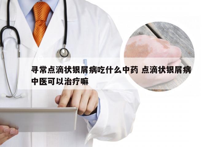 寻常点滴状银屑病吃什么中药 点滴状银屑病中医可以治疗嘛