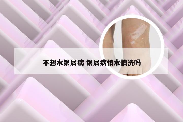 不想水银屑病 银屑病怕水怕洗吗