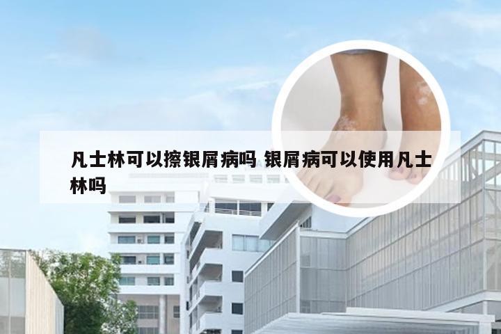 凡士林可以擦银屑病吗 银屑病可以使用凡士林吗