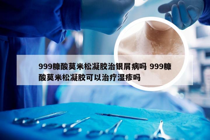 999糠酸莫米松凝胶治银屑病吗 999糠酸莫米松凝胶可以治疗湿疹吗