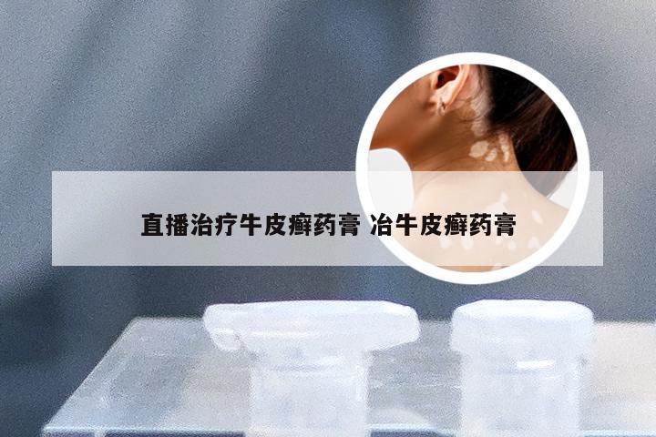 直播治疗牛皮癣药膏 冶牛皮癣药膏