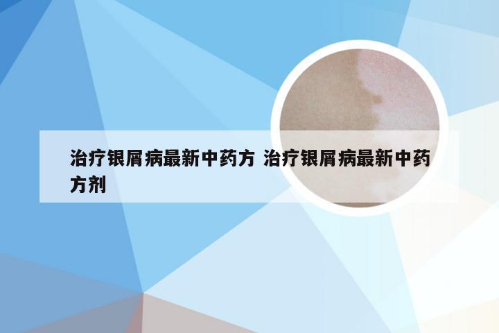 治疗银屑病最新中药方 治疗银屑病最新中药方剂