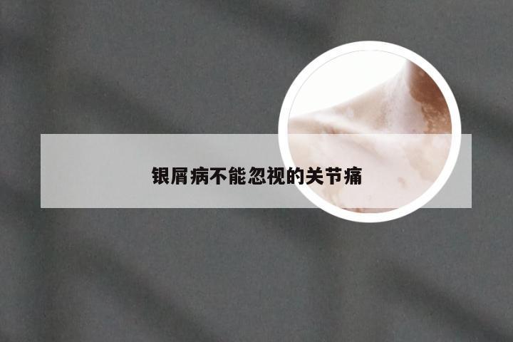 银屑病不能忽视的关节痛
