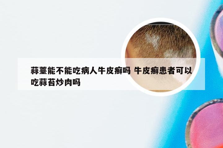 蒜薹能不能吃病人牛皮癣吗 牛皮癣患者可以吃蒜苔炒肉吗