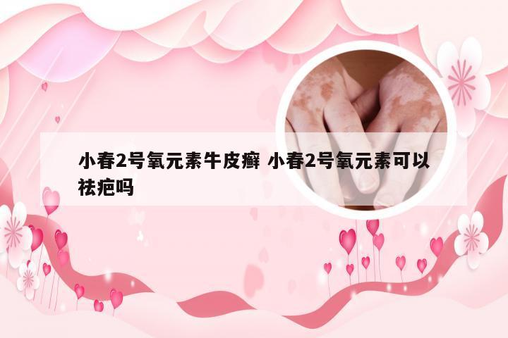小春2号氧元素牛皮癣 小春2号氧元素可以祛疤吗