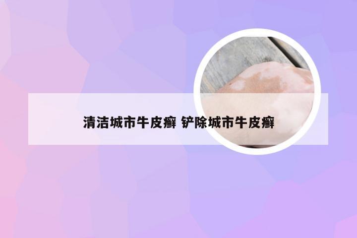 清洁城市牛皮癣 铲除城市牛皮癣