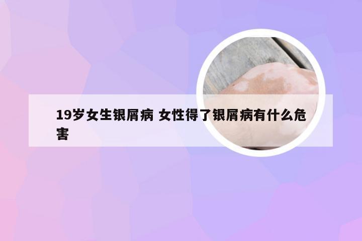 19岁女生银屑病 女性得了银屑病有什么危害