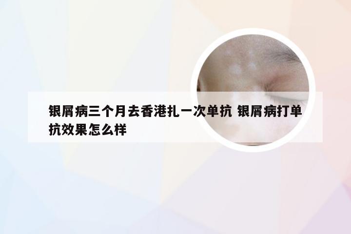 银屑病三个月去香港扎一次单抗 银屑病打单抗效果怎么样