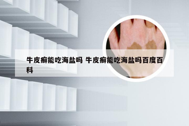 牛皮癣能吃海盐吗 牛皮癣能吃海盐吗百度百科