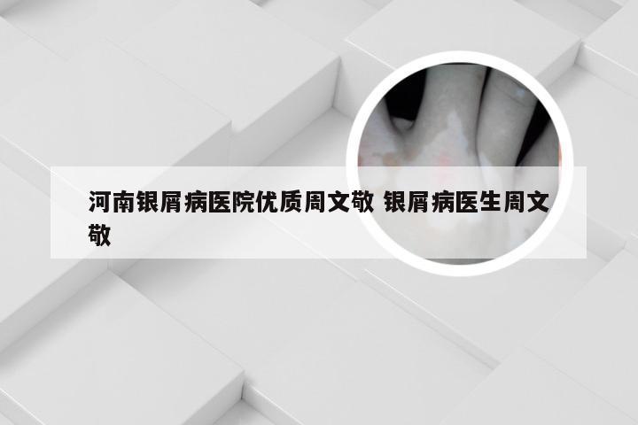 河南银屑病医院优质周文敬 银屑病医生周文敬