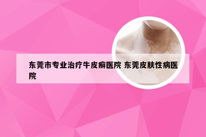 东莞市专业治疗牛皮癣医院 东莞皮肤性病医院