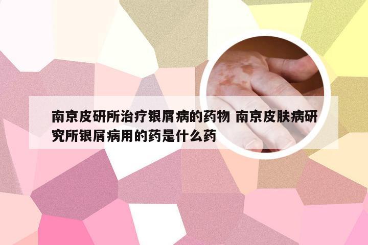 南京皮研所治疗银屑病的药物 南京皮肤病研究所银屑病用的药是什么药