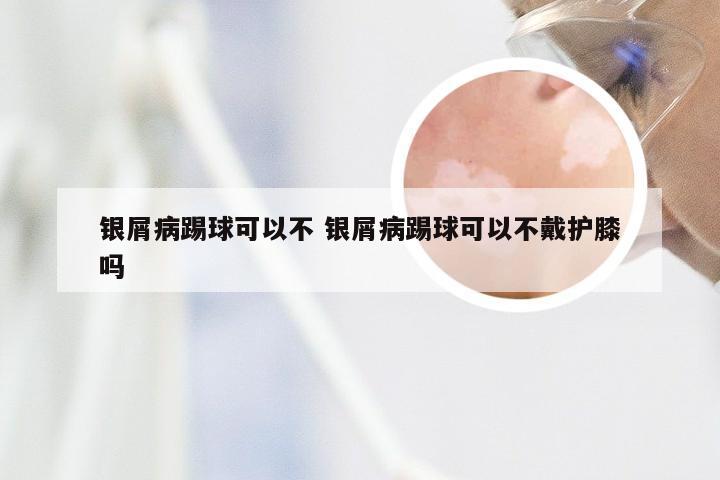 银屑病踢球可以不 银屑病踢球可以不戴护膝吗