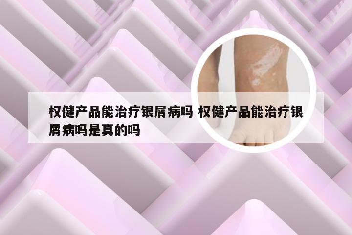 权健产品能治疗银屑病吗 权健产品能治疗银屑病吗是真的吗