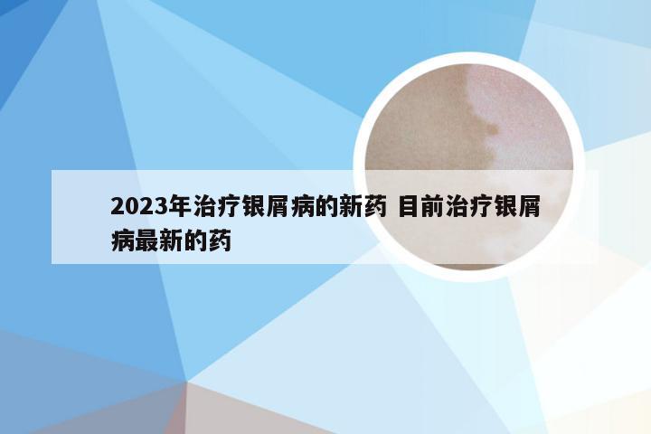 2023年治疗银屑病的新药 目前治疗银屑病最新的药
