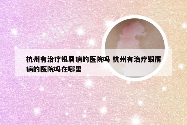 杭州有治疗银屑病的医院吗 杭州有治疗银屑病的医院吗在哪里