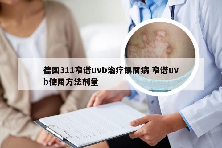德国311窄谱uvb治疗银屑病 窄谱uvb使用方法剂量