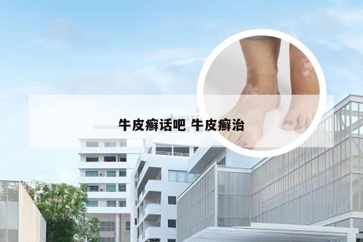 牛皮癣话吧 牛皮癣治