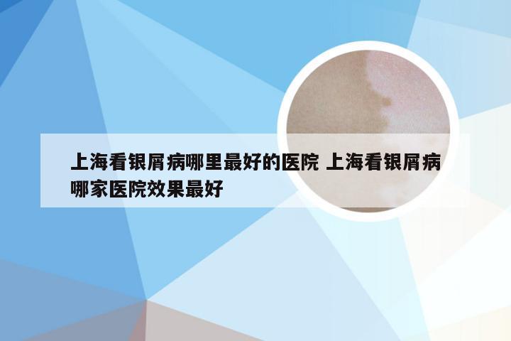 上海看银屑病哪里最好的医院 上海看银屑病哪家医院效果最好
