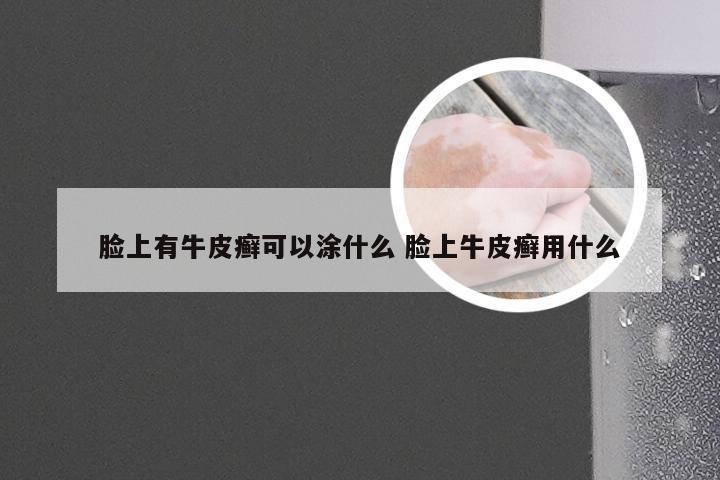 脸上有牛皮癣可以涂什么 脸上牛皮癣用什么