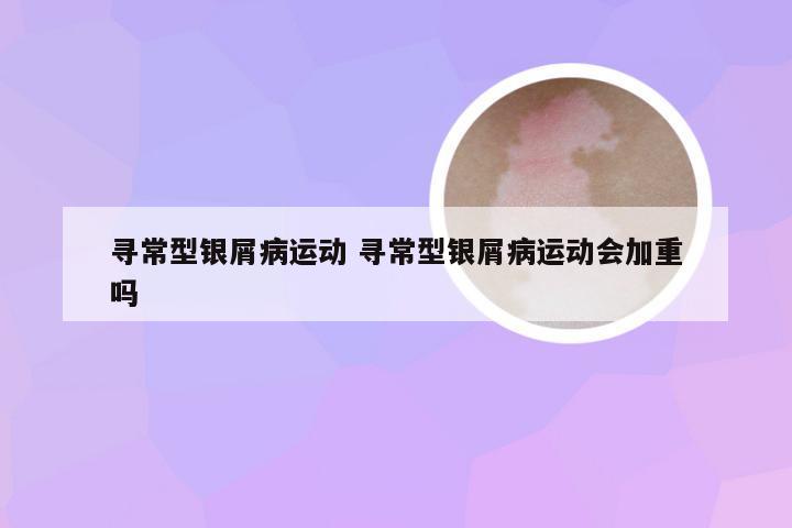 寻常型银屑病运动 寻常型银屑病运动会加重吗