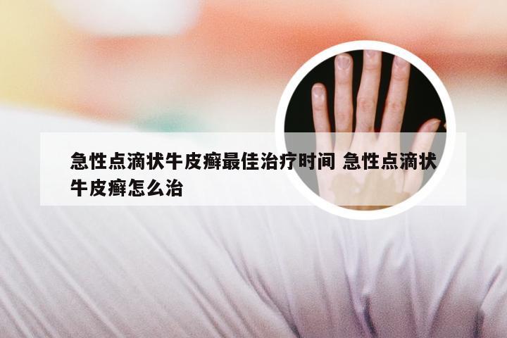 急性点滴状牛皮癣最佳治疗时间 急性点滴状牛皮癣怎么治