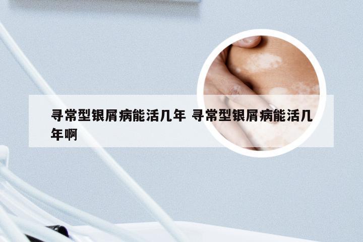 寻常型银屑病能活几年 寻常型银屑病能活几年啊