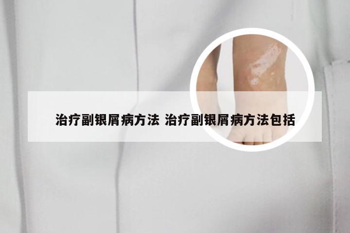 治疗副银屑病方法 治疗副银屑病方法包括