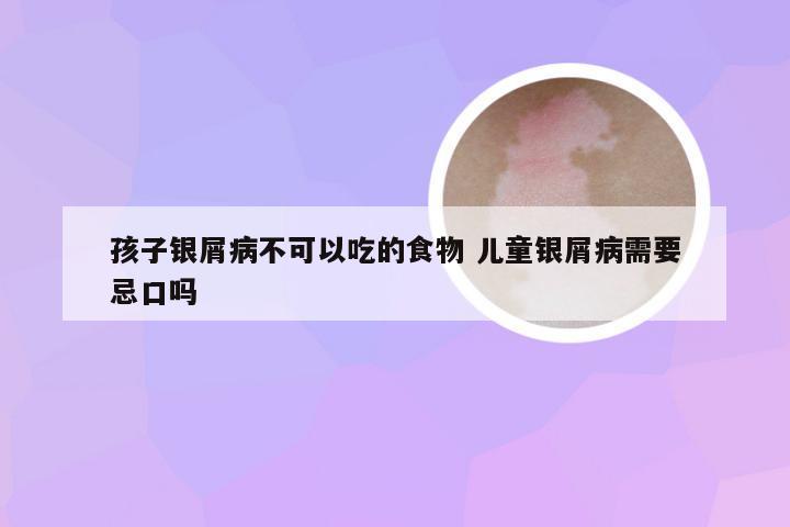 孩子银屑病不可以吃的食物 儿童银屑病需要忌口吗
