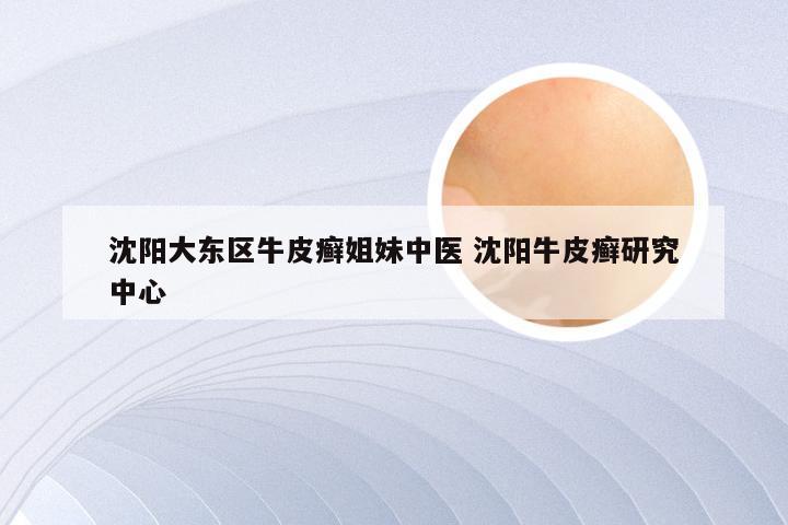 沈阳大东区牛皮癣姐妹中医 沈阳牛皮癣研究中心