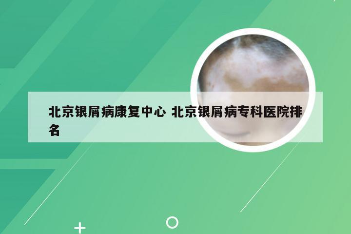北京银屑病康复中心 北京银屑病专科医院排名