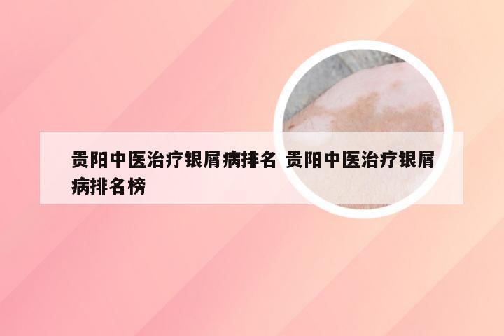 贵阳中医治疗银屑病排名 贵阳中医治疗银屑病排名榜