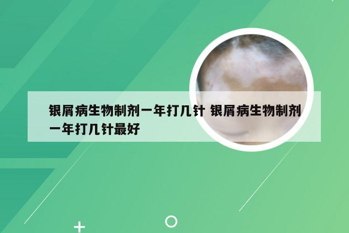 银屑病生物制剂一年打几针 银屑病生物制剂一年打几针最好